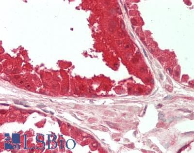 IHC-plus™ ACLY / ATP Citrate Lyase Antibody (aa350-400)