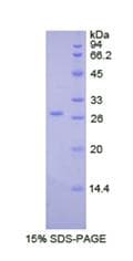 Human LOXL2 Protein (Recombinant His)