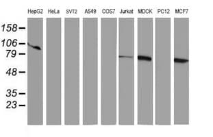 RPN1 / Ribophorin I Antibody (clone OTI2G1)