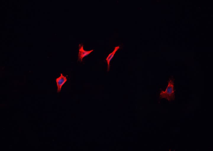 Polyclonal Rabbit anti-Human HRS / HGS Antibody (IHC, IF, WB)