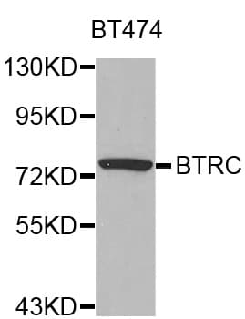 BTRCP / BETA-TRCP Antibody