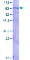 Human BEST1 / BEST / Bestrophin Protein (Recombinant GST)