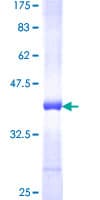 Human AP3B1 Protein (Recombinant GST, N-terminus)