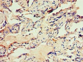 ITGB3 / Integrin Beta 3 / CD61 Antibody (aa609-788)