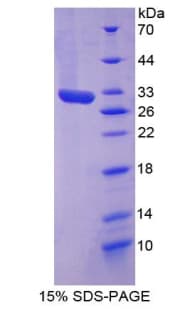 Rat VCAM1 / CD106 Protein (Recombinant His-T7)