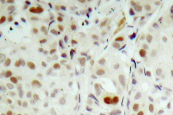 Polyclonal Rabbit anti-Human RB1 / Retinoblastoma / RB Antibody (phospho-Ser807, IHC, WB)