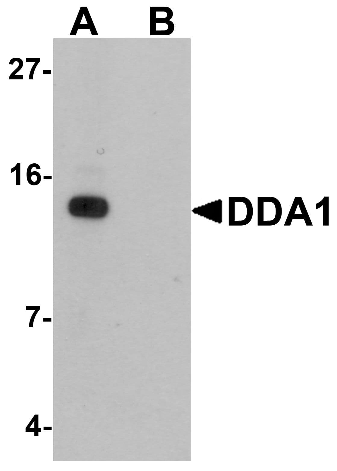 IHC-plus™ Polyclonal Rabbit anti-Human DDA1 Antibody (IHC, IF, WB)