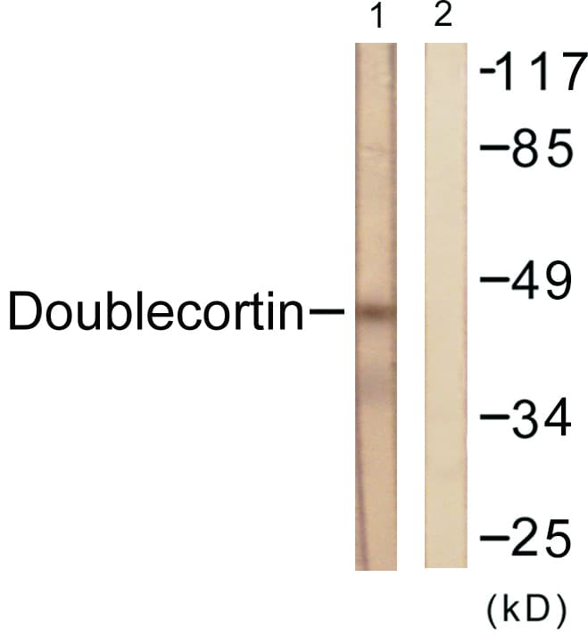 DCX / Doublecortin Antibody (aa206-255)