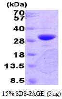 Human PNMT Protein (Recombinant)
