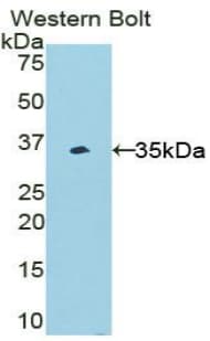 BLIMP1 / PRDM1 Antibody (aa541-815, Biotin)