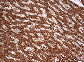 PARN Antibody (aa1-266, clone OTI4D12)
