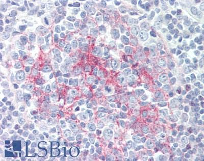 PathPlus™ Monoclonal Mouse anti-Human CR2 / CD21 Antibody (clone Bu33, IHC)