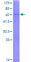 Human MTFMT Protein (Recombinant GST)