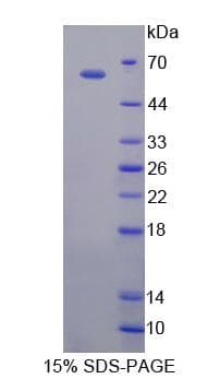 Human Eomesodermin / EOMES Protein (Recombinant His-GST, N-terminus)
