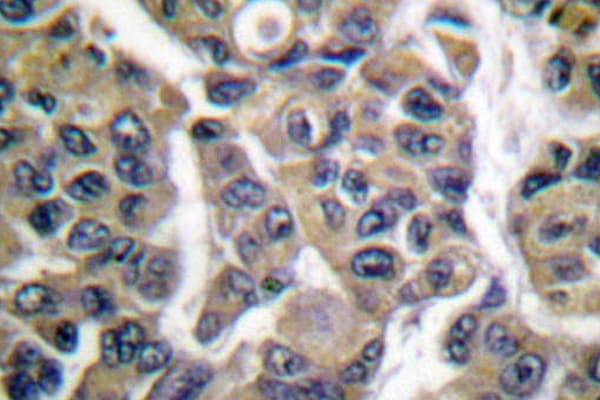 MAGEA1 / MAGE 1 Antibody (Phe293)