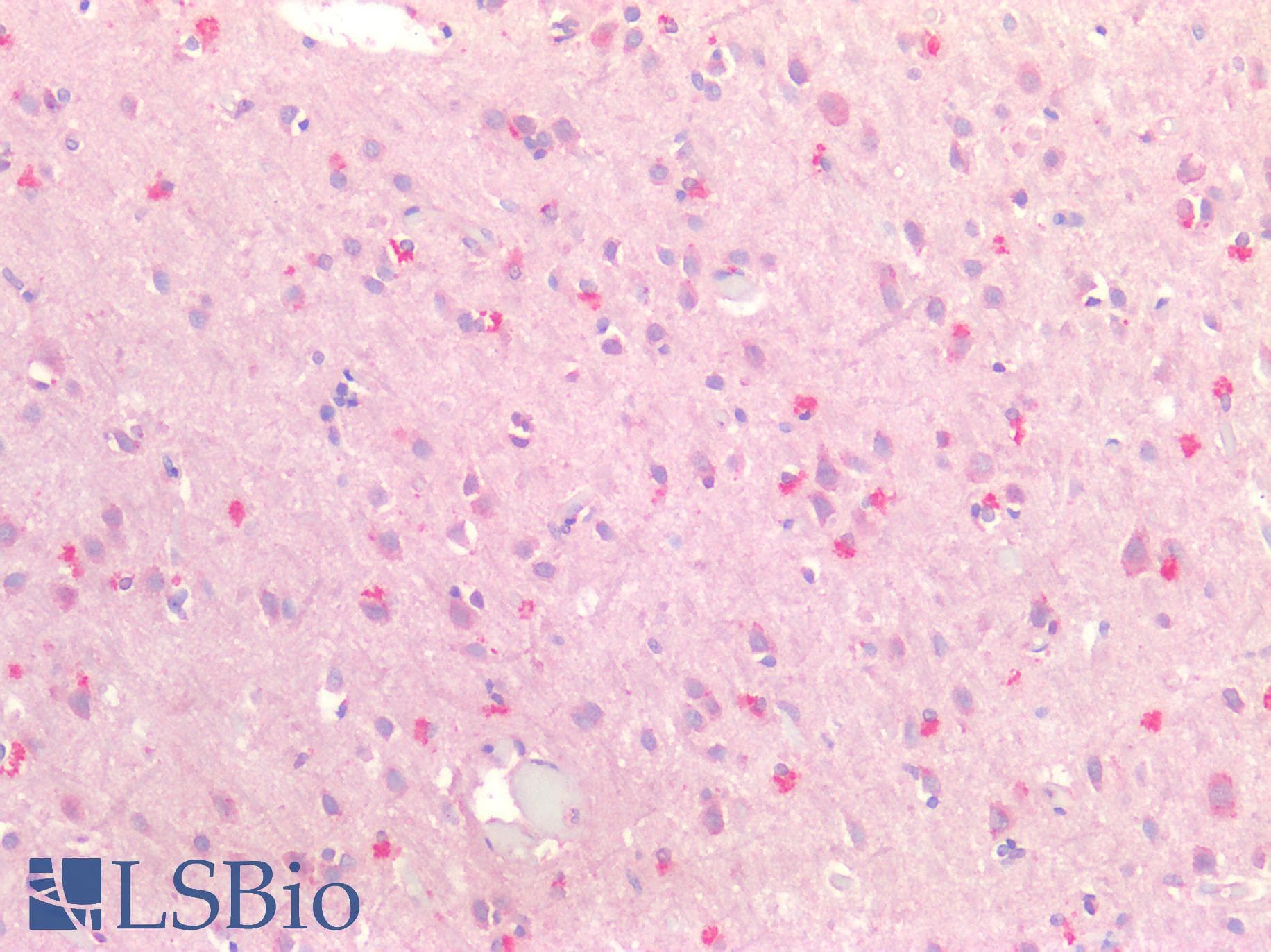 IHC-plus™ Polyclonal Rabbit anti-Human MAPRE2 / EB2 Antibody (IHC)