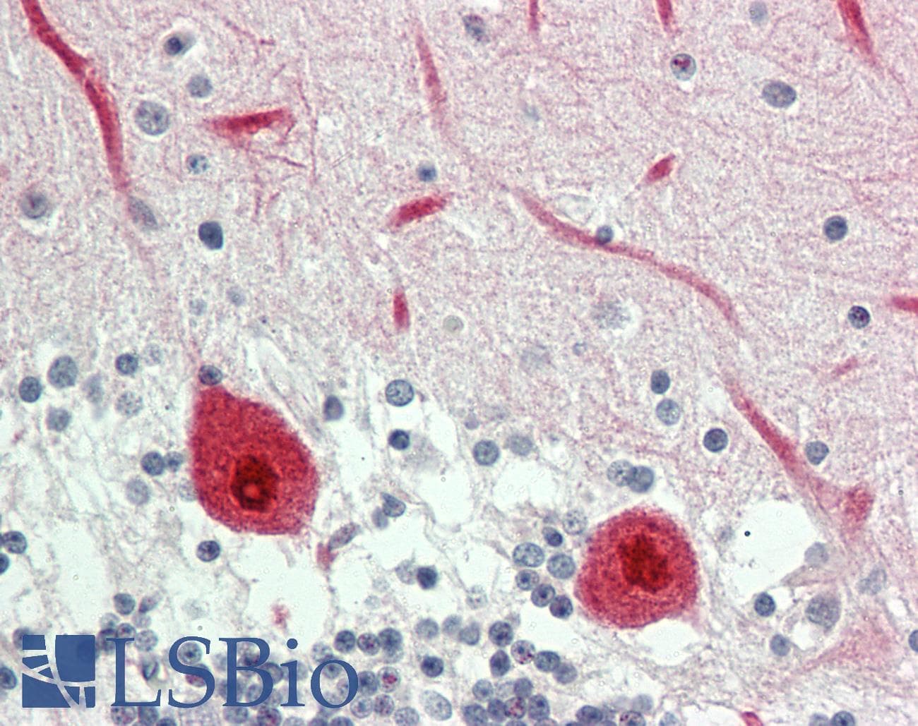 IHC-plus™ P2RY11 / P2Y11 Antibody (aa130-179)