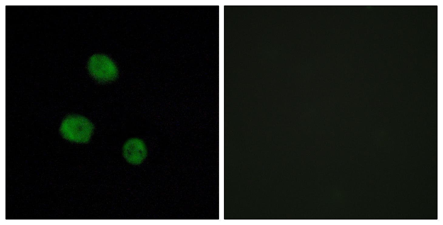 Polyclonal Rabbit anti-Human HNRPM / HNRNPM Antibody (IHC, IF, WB)