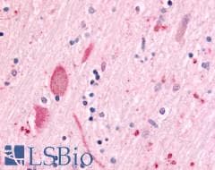 PathPlus™ Polyclonal Rabbit anti-Human MINK1 / MINK Antibody (Internal, IHC)