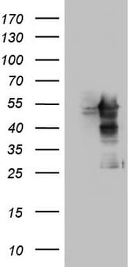 MAPKAPK5 / PRAK Antibody (aa197-471, clone OTI4G4)