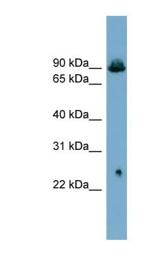 SLC6A5 / GLYT2 Antibody (aa503-552)