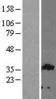 GIPC2 Protein (Over-Expression Lysate Myc-DDK (Flag))
