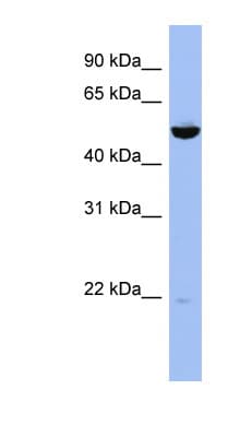 MAP2K7 / MEK7 Antibody (aa287-336)