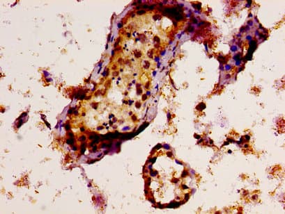 TAF15 Antibody