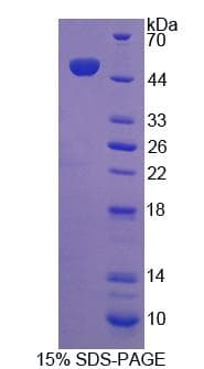 Human ABCA7 Protein (Recombinant His-GST, N-terminus)