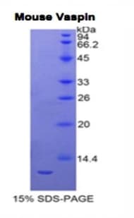 Mouse SERPINA12 / Vaspin Protein (Recombinant His)