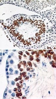 CCR6 Antibody (clone 18B9E6)