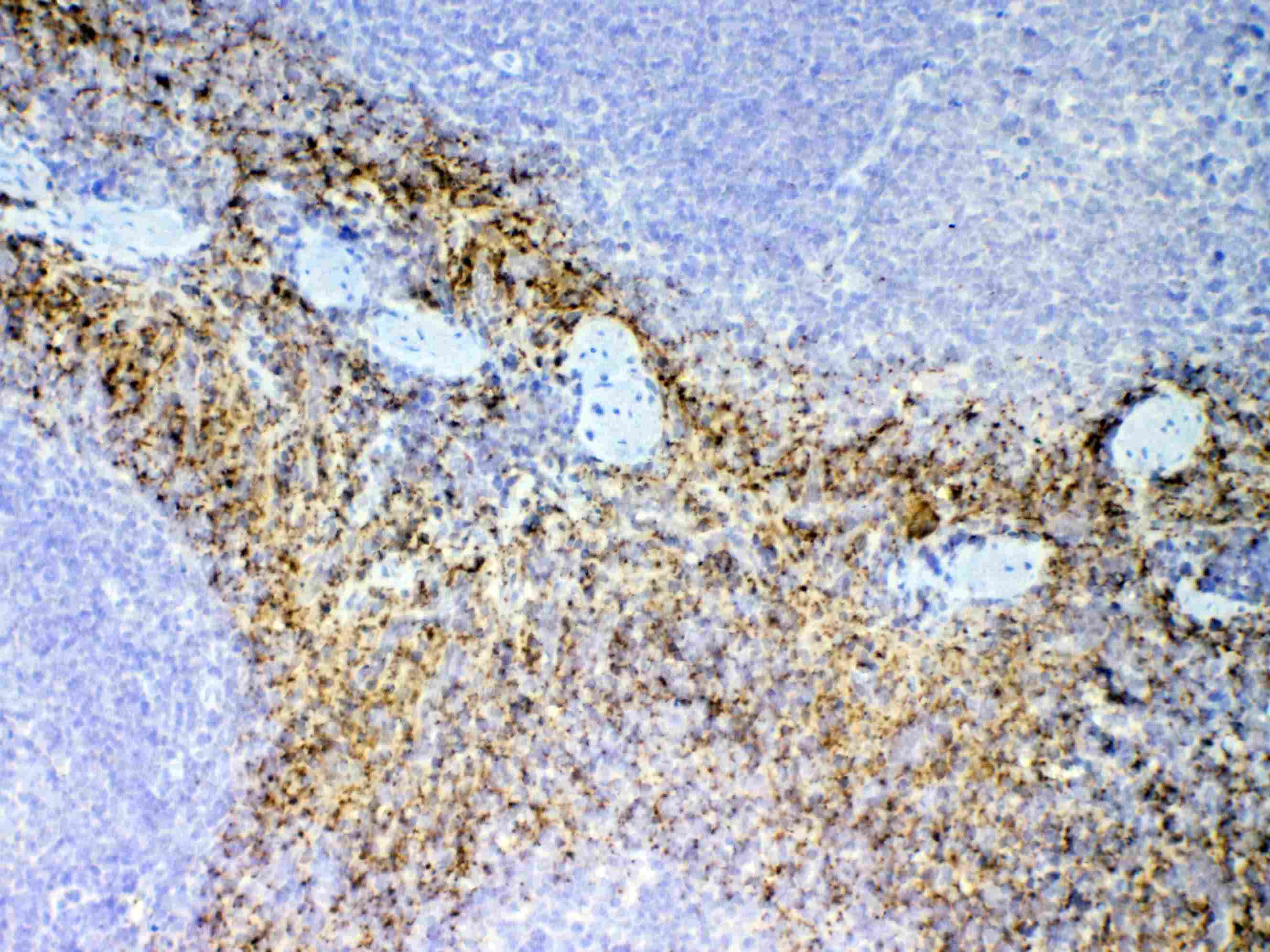 CXCL7 / PPBP Antibody