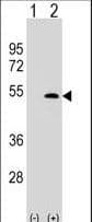 IHC-plus™ Polyclonal Rabbit anti-Human LYVE1 Antibody (aa46-77, IHC, WB)