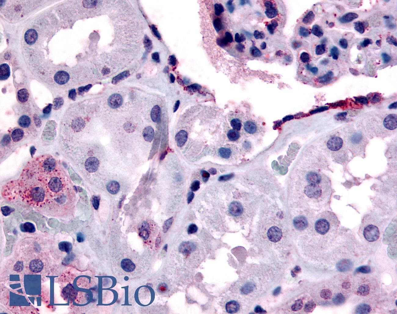 IHC-plus™ ERBB4 / HER4 Antibody (Internal)