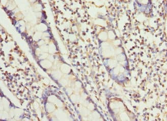 RUFY1 Antibody