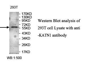 Polyclonal Rabbit anti-Human ZNF449 Antibody (aa190-482, WB)