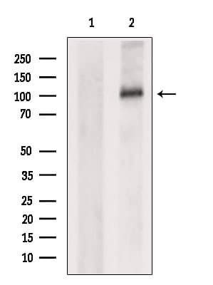 OSMR / IL-31R-Beta Antibody