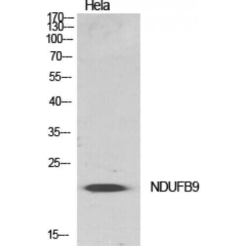 NDUFB9 Antibody (80-160 aa, Internal)
