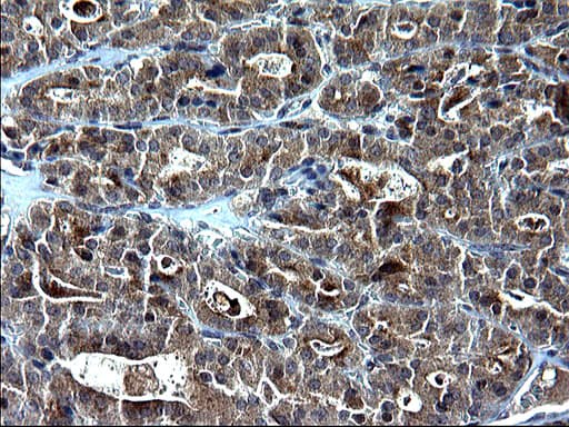 SCP2 / SCPX Antibody (clone OTI1D2)