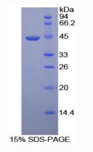 Mouse HYAL2 Protein (Recombinant His)