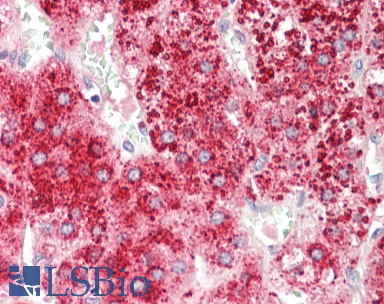 IHC-plus™ APOD / Apolipoprotein D Antibody (aa48-61)