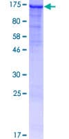 Human TLL2 Protein (Recombinant GST)