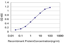 PAPSS2 Antibody (clone 2A8)