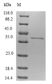 Human TP53AIP1 / p53 AIP1 Protein (Recombinant GST, N-terminus)