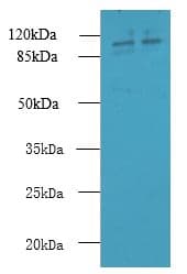RPGR Antibody