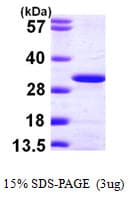 Human UBE2K / LIG Protein (Recombinant His)