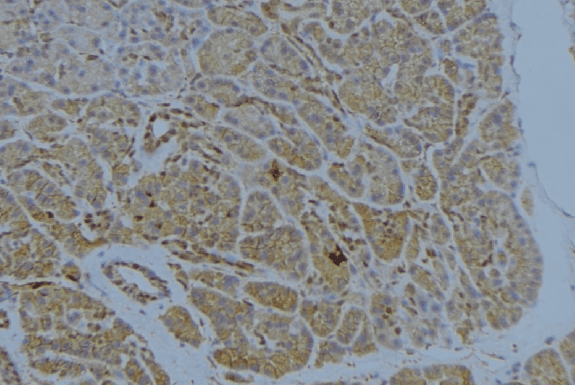 Polyclonal Rabbit anti-Human ST14 / Matriptase Antibody (IHC, IF, WB)