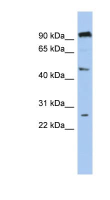 C1orf174 Antibody (aa107-156)