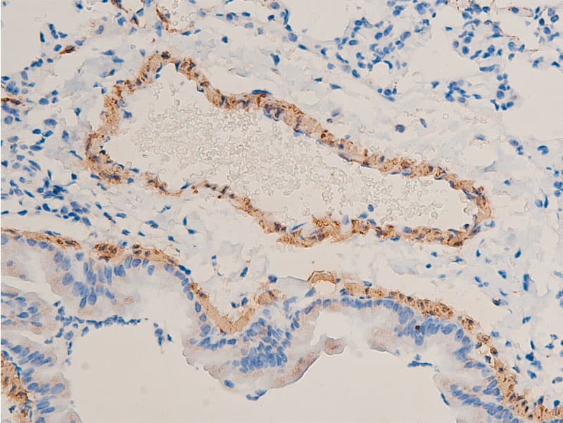 ACTA2 / Smooth Muscle Actin Antibody