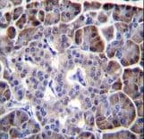 MYBPHL Antibody (aa80-108)